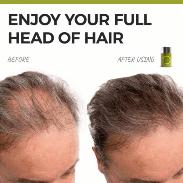 FOCUS HAIR THICKENING FIBERS FOR MEN AND WOMEN - REVITALIZE YOUR HAIR WITH TEXTURIZING HAIR FILLER - RAPIDLY CONCEAL ALOPECIA AREATA & HAIR LOSS - 6G / 0.21OZ - Image 2