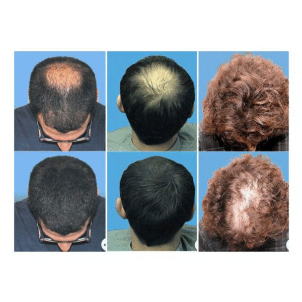 NANOGEN HAIR BUILDING NANOFIBRES (15 GRAMS) - Image 2